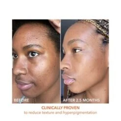 Dr Dennis Gross Alpha Beta Universal Daily Peel -Nursing Store Alpha Beta Universal Daily Peel add4 55577 3617 general