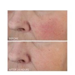 Dr Dennis Gross Vitamin C + Lactic Dewy Deep Cream -Nursing Store Vitamin C Lactic Dewy Deep Cream add3 68793 6217 general